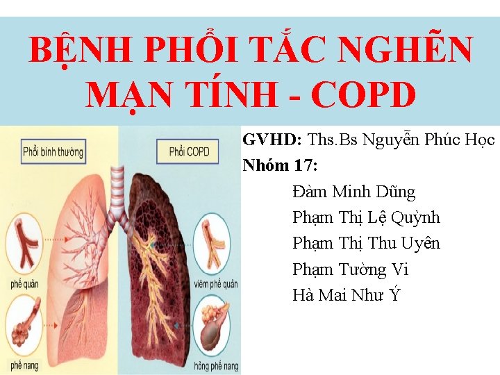 BỆNH PHỔI TẮC NGHẼN MẠN TÍNH - COPD GVHD: Ths. Bs Nguyễn Phúc Học