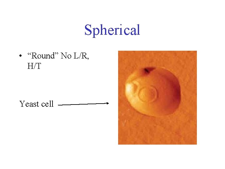 Spherical • “Round” No L/R, H/T Yeast cell 