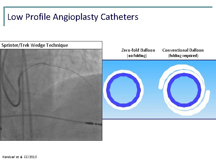 Low Profile Angioplasty Catheters Sprinter/Trek Wedge Technique Zero-fold 1. 25 mm balloon 0. 020” Low Profile Angioplasty Catheters Sprinter/Trek Wedge Technique Zero-fold 1. 25 mm balloon 0. 020”