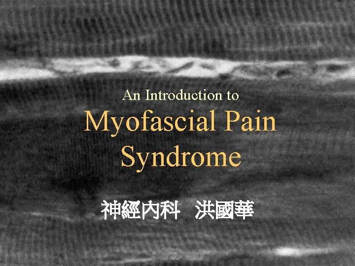 An Introduction to Myofascial Pain Syndrome 神經內科 洪國華 