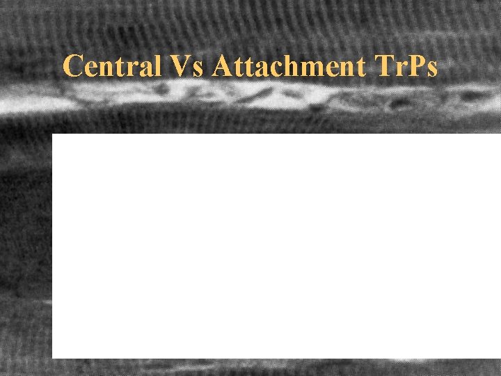 Central Vs Attachment Tr. Ps 