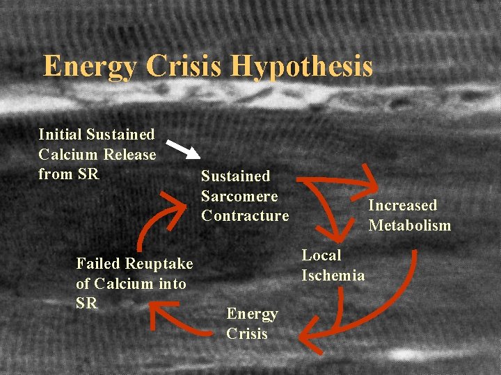 Energy Crisis Hypothesis Initial Sustained Calcium Release from SR Failed Reuptake of Calcium into