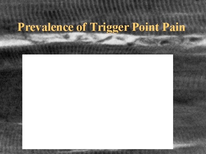 Prevalence of Trigger Point Pain 