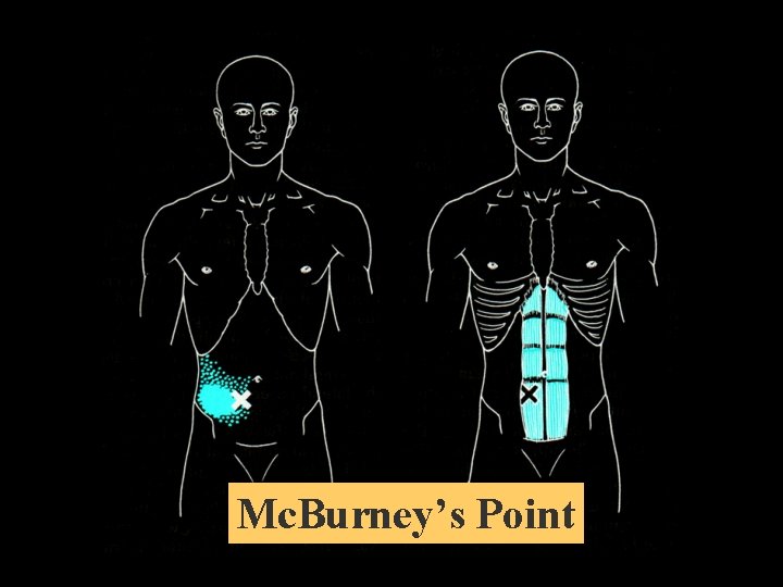 Mc. Burney’s Point 