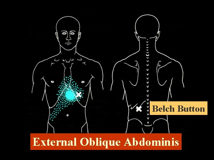 Belch Button External Oblique Abdominis 