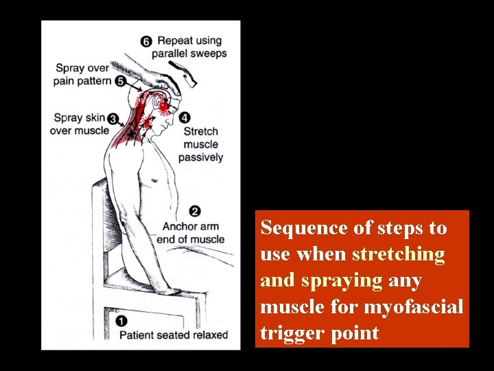 Sequence of steps to use when stretching and spraying any muscle for myofascial trigger
