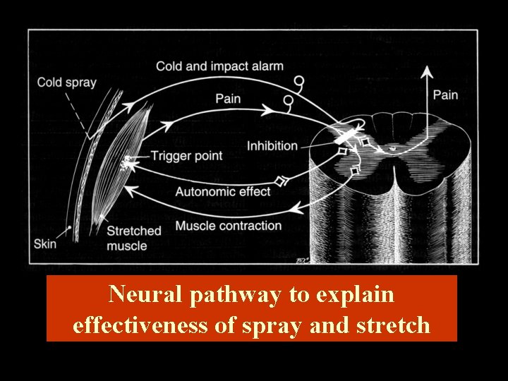 Neural pathway to explain effectiveness of spray and stretch 