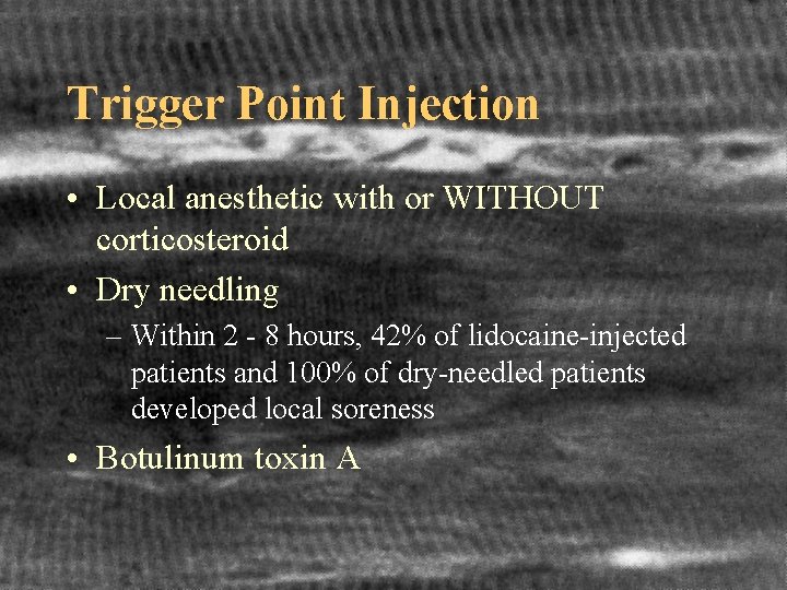 Trigger Point Injection • Local anesthetic with or WITHOUT corticosteroid • Dry needling –