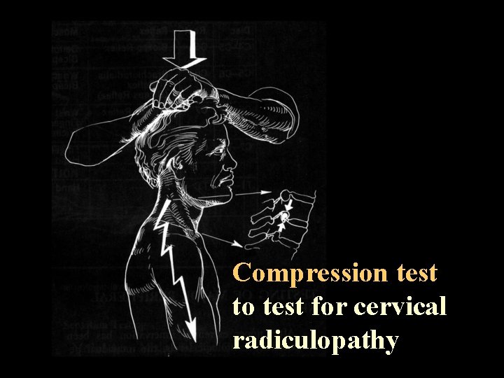 Compression test to test for cervical radiculopathy 