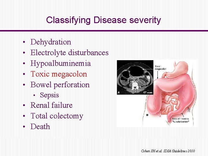 Classifying Disease severity • • • Dehydration Electrolyte disturbances Hypoalbuminemia Toxic megacolon Bowel perforation