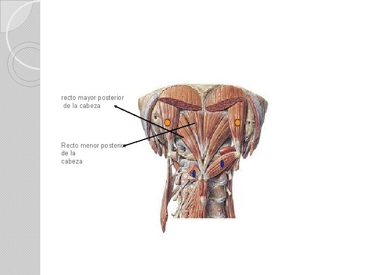 recto mayor posterior de la cabeza Recto menor posterior de la cabeza 