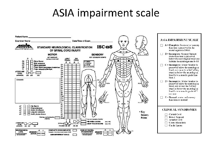Spinal Metastasis Epidemiology 1 2 million new cancer