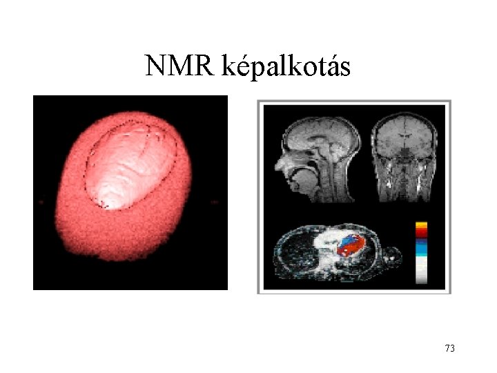 NMR képalkotás 73 