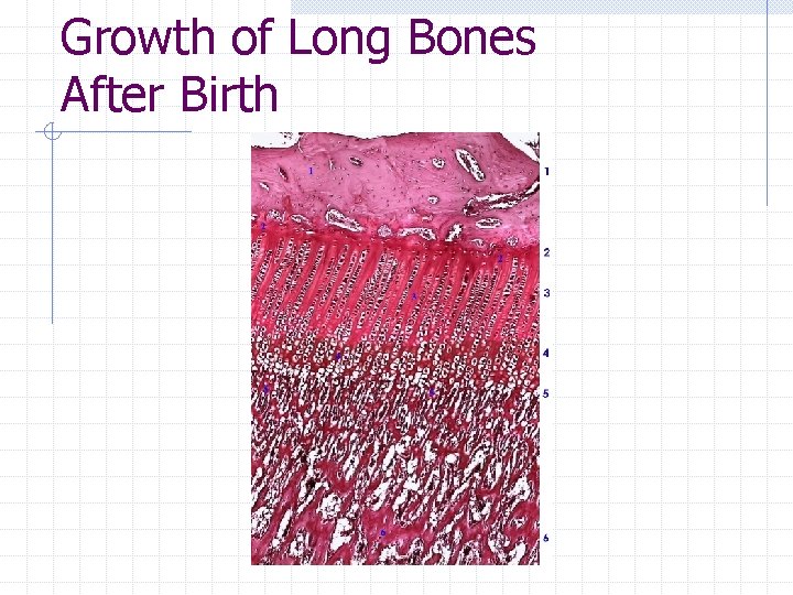 Growth of Long Bones After Birth Growth of Long Bones After Birth