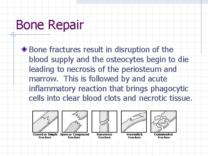 Bone Repair Bone fractures result in disruption of the blood supply and the osteocytes Bone Repair Bone fractures result in disruption of the blood supply and the osteocytes