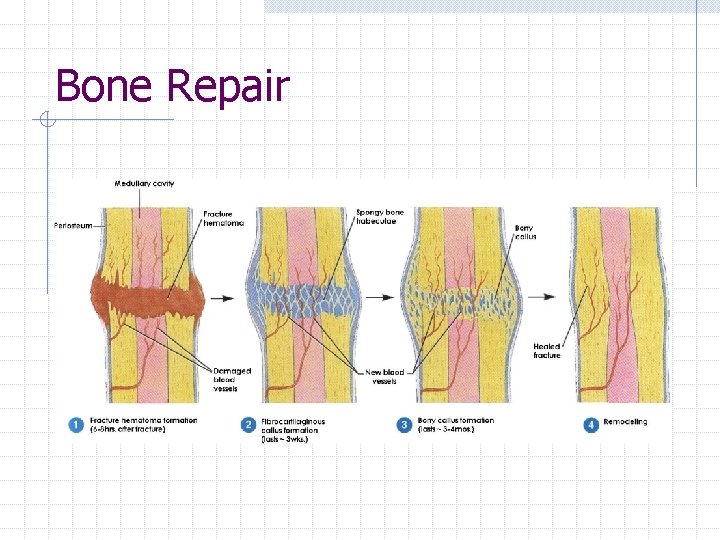 Bone Repair Bone Repair