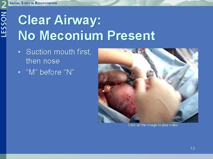 Clear Airway: No Meconium Present • Suction mouth first, then nose • “M” before