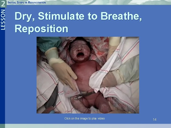 Dry, Stimulate to Breathe, Reposition Click on the image to play video 14 