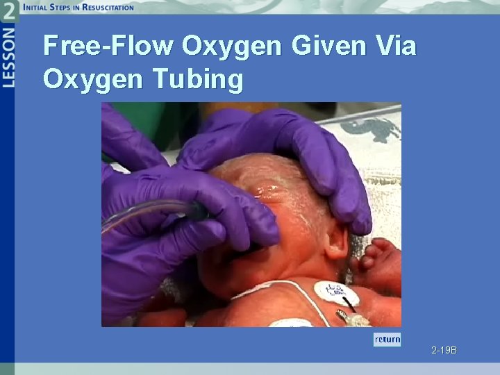 Free-Flow Oxygen Given Via Oxygen Tubing 2 -19 B 