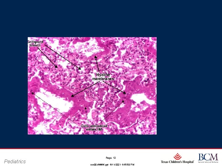 Pediatrics Page 12 xxx 00. #####. ppt 6/11/2021 4: 45: 59 PM Pediatrics Page 12 xxx 00. #####. ppt 6/11/2021 4: 45: 59 PM