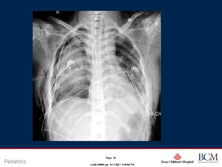 Pediatrics Page 16 xxx 00. #####. ppt 6/11/2021 4: 46: 09 PM Pediatrics Page 16 xxx 00. #####. ppt 6/11/2021 4: 46: 09 PM