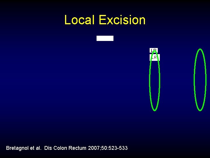 Local Excision LR Bretagnol et al. Dis Colon Rectum 2007; 50: 523 -533 