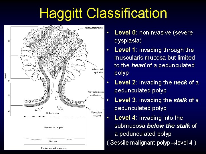 Haggitt Classification • Level 0: noninvasive (severe dysplasia) • Level 1: invading through the