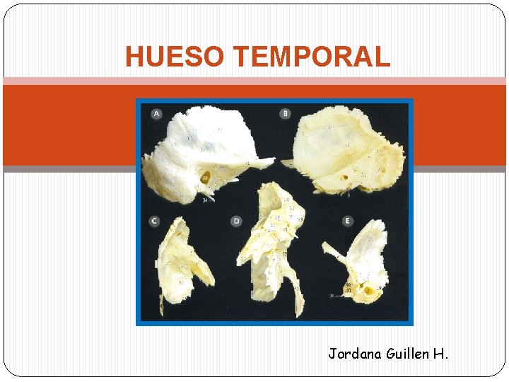 HUESO TEMPORAL Jordana Guillen H. 