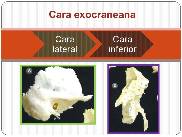 Cara exocraneana Cara lateral Cara inferior 