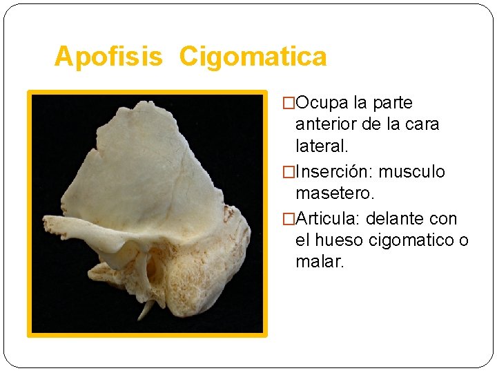 Apofisis Cigomatica �Ocupa la parte anterior de la cara lateral. �Inserción: musculo masetero. �Articula: