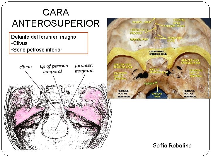 CARA ANTEROSUPERIOR Delante del foramen magno: • Clivus • Seno petroso inferior Sofía Robalino