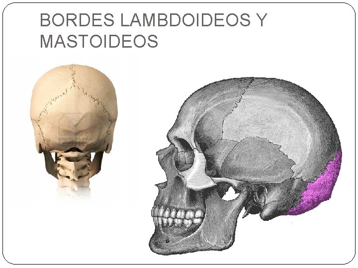 BORDES LAMBDOIDEOS Y MASTOIDEOS 