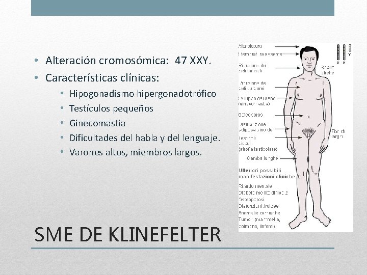  • Alteración cromosómica: 47 XXY. • Características clínicas: • • • Hipogonadismo hipergonadotrófico