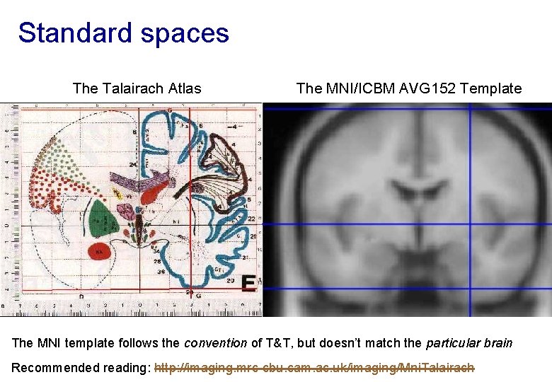 Standard spaces The Talairach Atlas The MNI/ICBM AVG 152 Template The MNI template follows