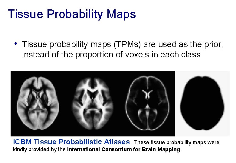Tissue Probability Maps • Tissue probability maps (TPMs) are used as the prior, instead