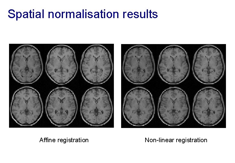 Spatial normalisation results Affine registration Non-linear registration 