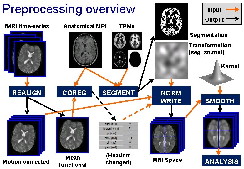 Preprocessing overview Input Output f. MRI time-series Anatomical MRI TPMs Segmentation Transformation (seg_sn. mat)