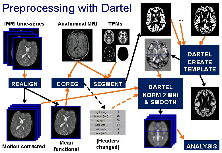 Preprocessing with Dartel f. MRI time-series Anatomical MRI . . . TPMs DARTEL CREATE