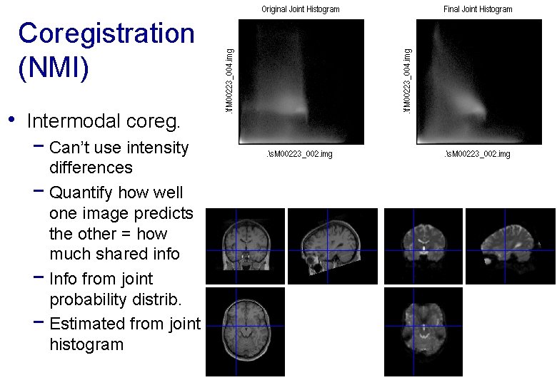 Coregistration (NMI) • Intermodal coreg. − Can’t use intensity differences − Quantify how well
