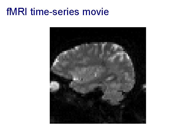 f. MRI time-series movie 