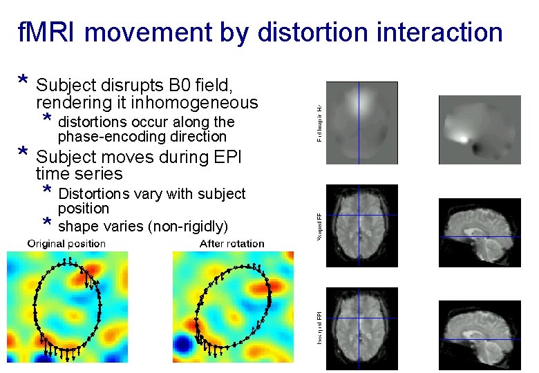 f. MRI movement by distortion interaction * Subject disrupts B 0 field, rendering it