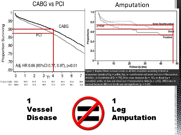 Amputation 1 Vessel Disease 1 Leg Amputation 