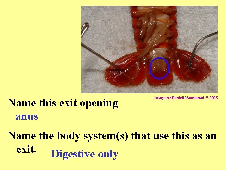 Name this exit opening anus Image by Riedell/Vanderwal © 2005 Name the body system(s)