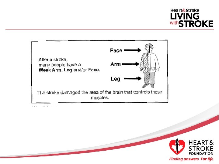 Stroke Module Understanding Stroke Topics Module 1 Understanding stroke Module