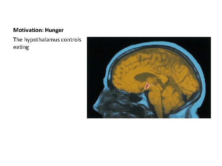 Motivation: Hunger The hypothalamus controls eating 