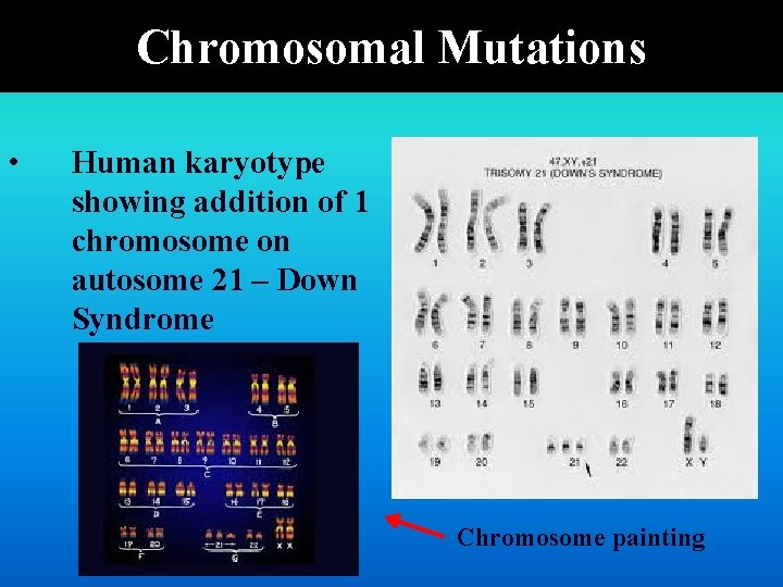 Chromosomal Mutations • Human karyotype showing addition of 1 chromosome on autosome 21 –
