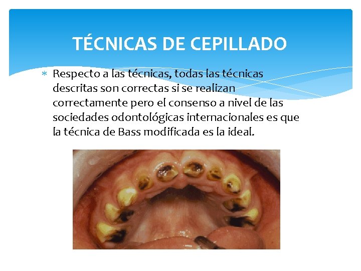 TÉCNICAS DE CEPILLADO Respecto a las técnicas, todas las técnicas descritas son correctas si