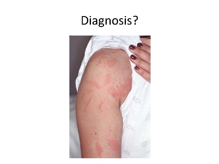 Diagnosis? 