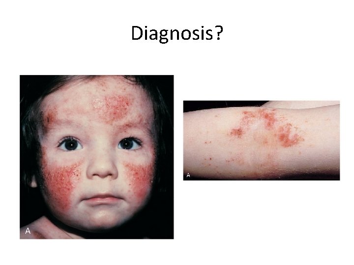 Diagnosis? 
