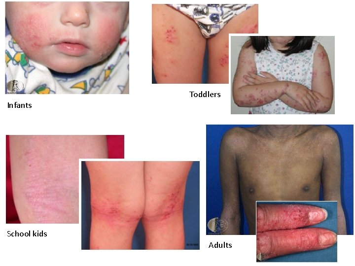 Toddlers Infants School kids Adults 